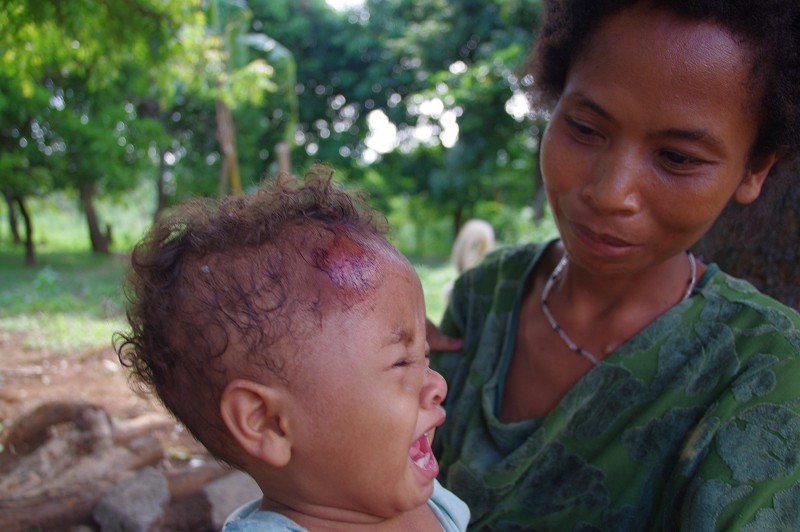 Donation_Aeta_Zambales_06_2011_082